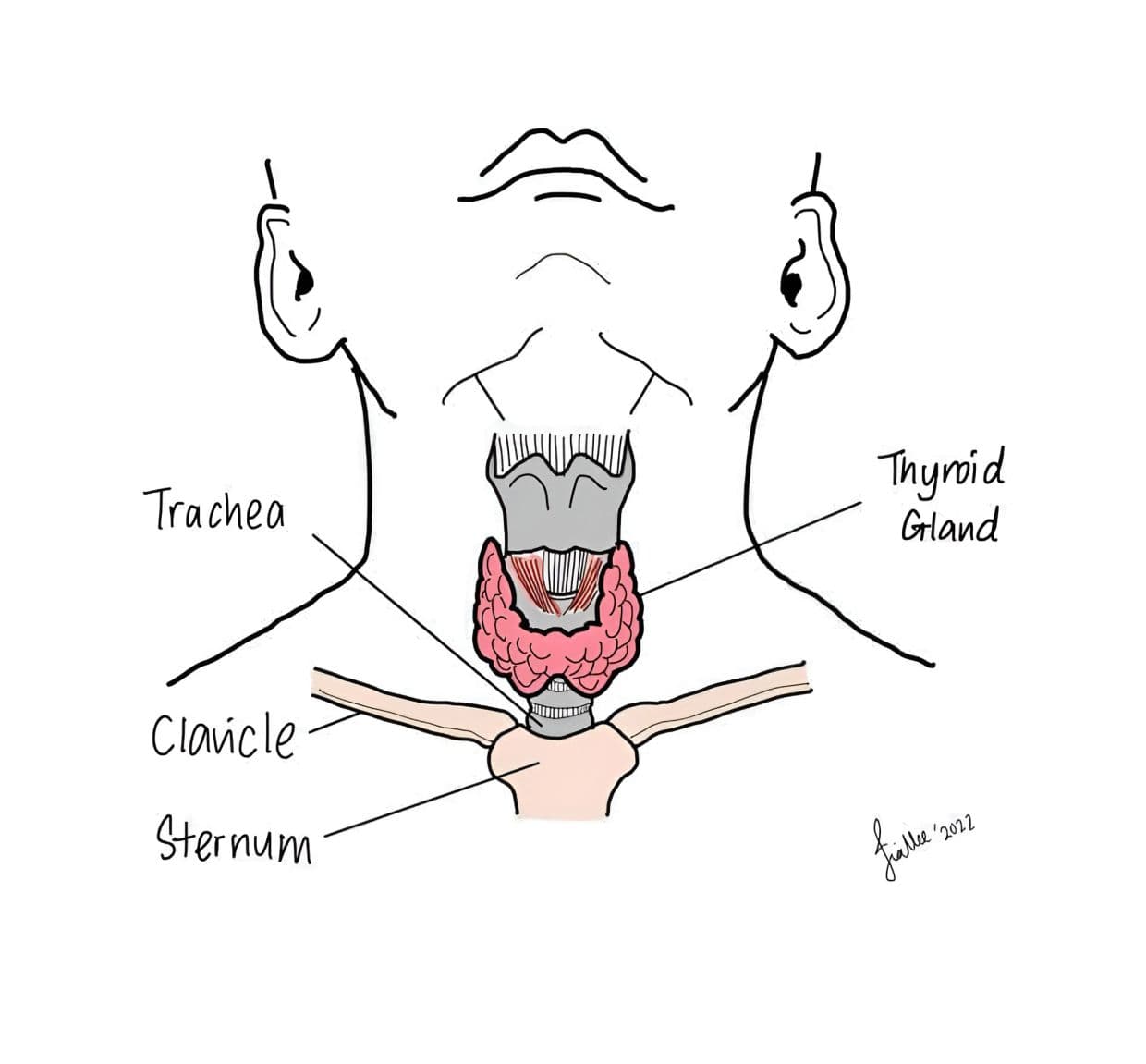 When a child's thyroid gland goes into overdrive | The Star