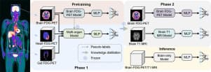 Multi-organ guided diagnosis of mild cognitive impairment ...