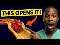 #1 Best Protocol to UNCLOG Your Arteries (Cardiologist Explains)