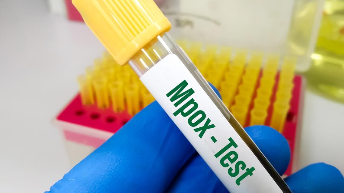 Federal researchers charged with smuggling mpox virus samples through Detroit Metro Airport