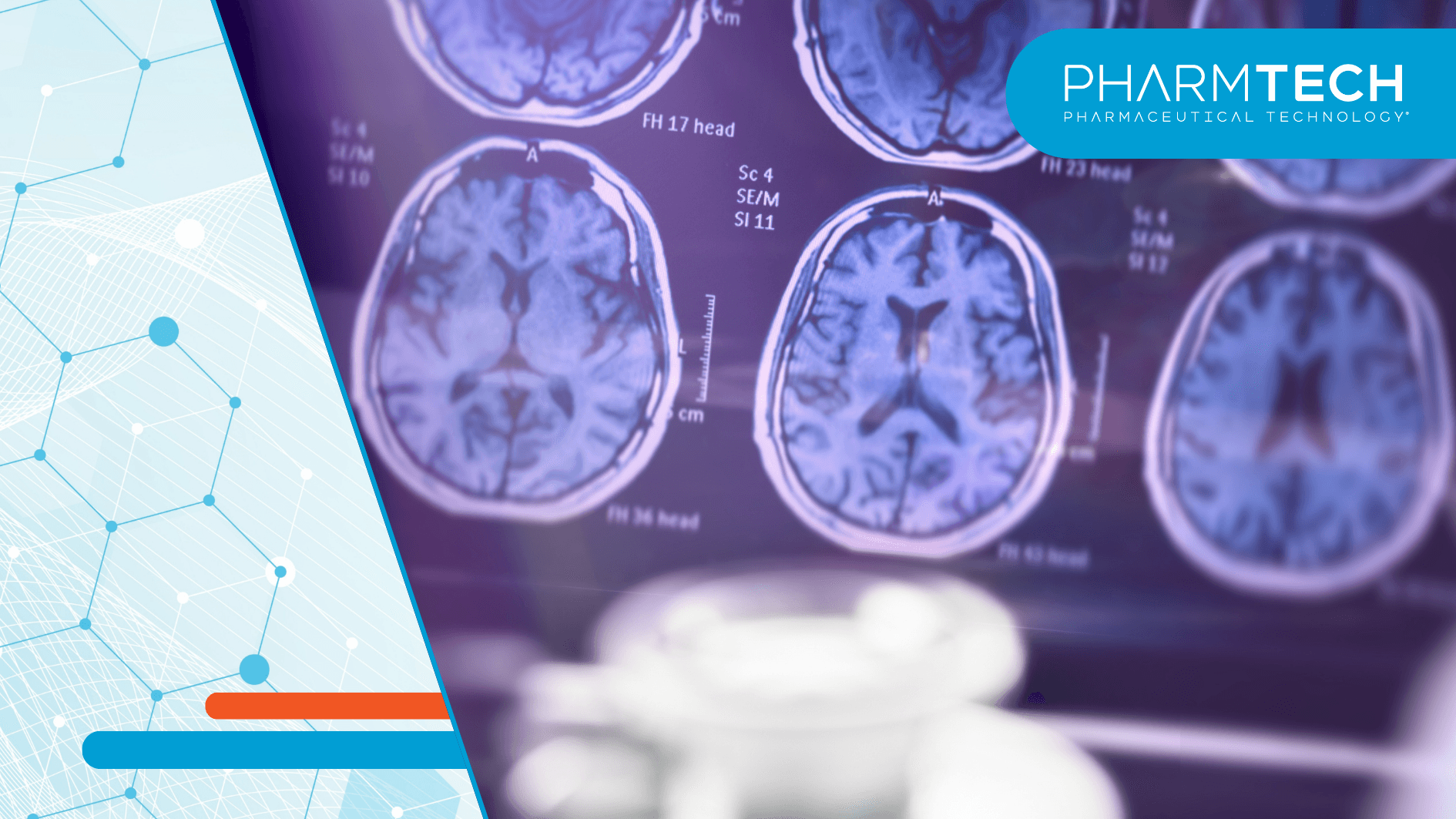 What Does TAUKLARIFY's Approval Mean for Alzheimer's ...