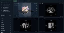 @gdb: Astra for medical education: