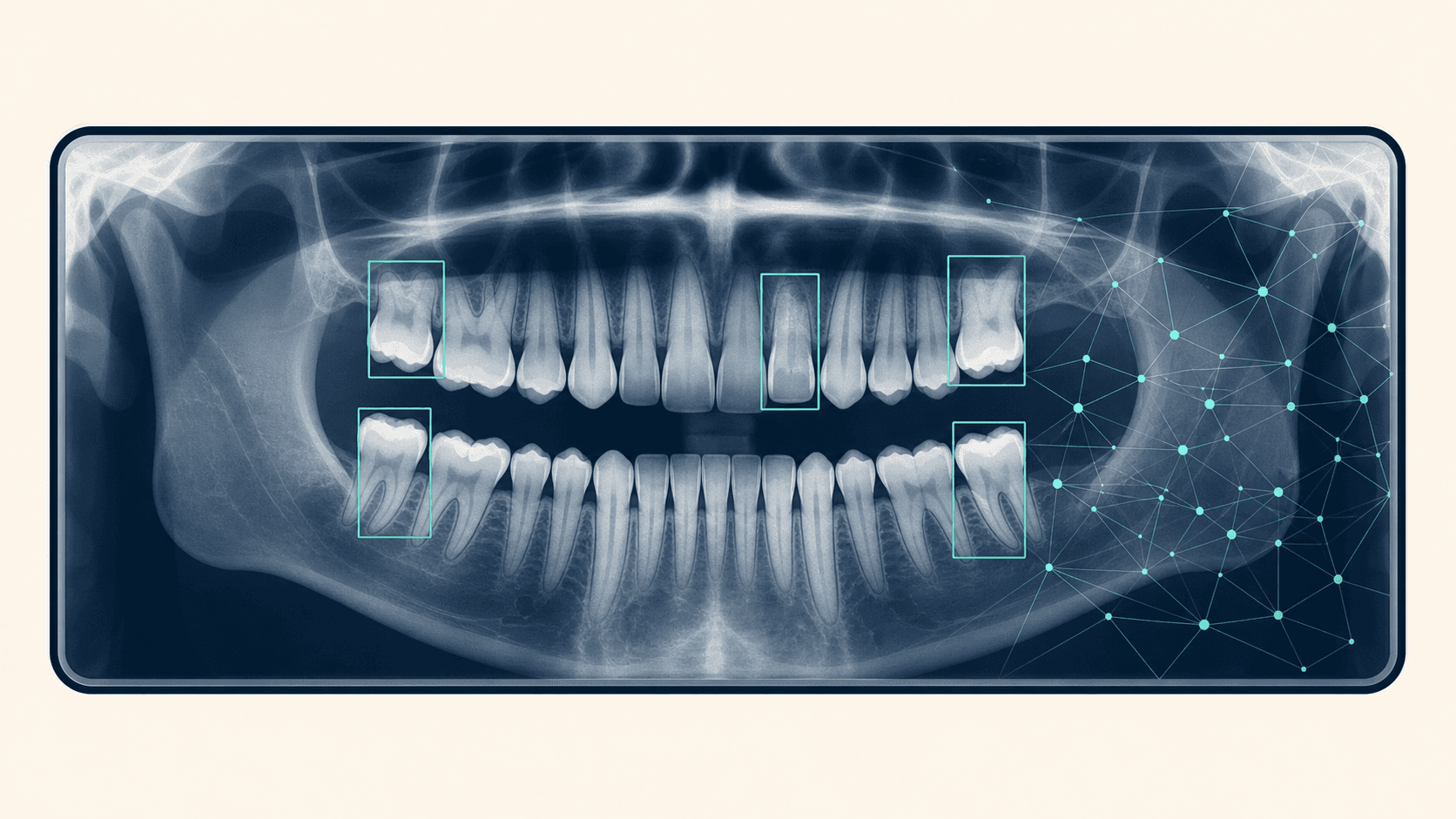 Overjet Review (2026): Dental AI Imaging & Alternatives