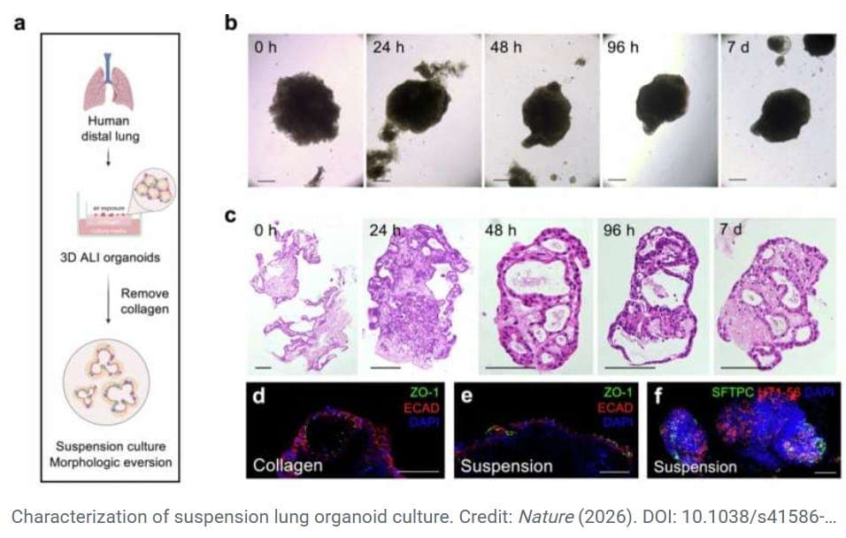 Human Lung Organoids with a Built-In Immune System Could Transform Respiratory Disease Research