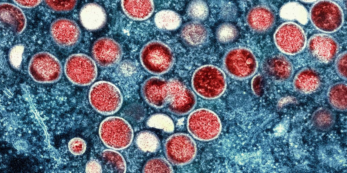 Two scientists charged with smuggling monkeypox virus through Detroit airport