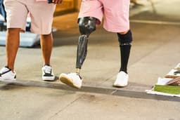 VA Benefits Change Impacts Thousands of Veterans Expecting Prosthetic Limbs