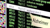 Test Combo Predicts Alzheimer's Years in Advance - Mirage News