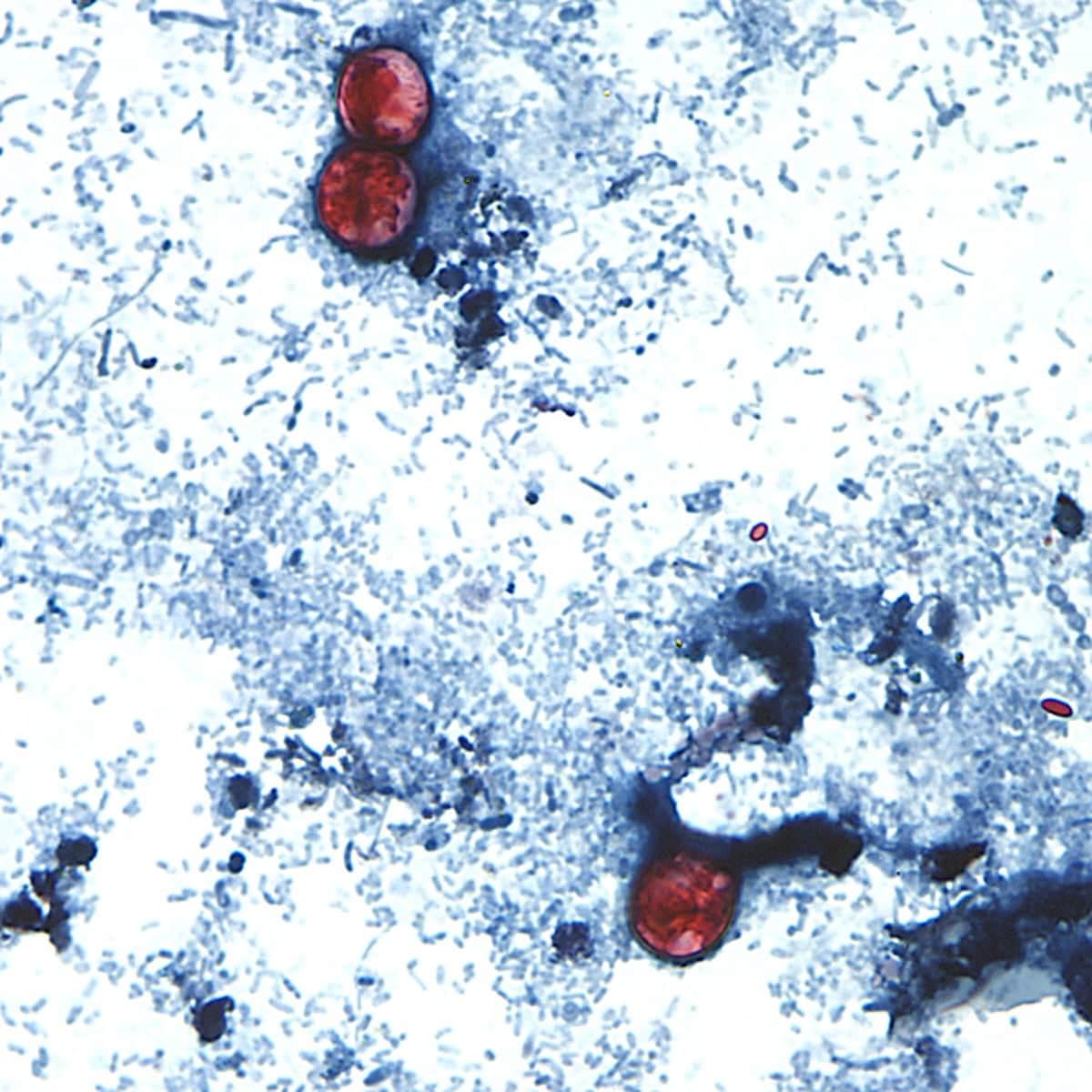Why we don't know what food is spreading the parasite ...