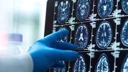Abbott pens blood-based Alzheimer's testing deal with ...