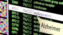 Blood and Gene Test Combo Forecasts Alzheimer's Symptoms ...
