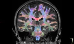 Brain Matters: Equity In The Age Of Cognitive Health - Health Policy Watch