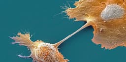 Breakthrough drug nearly doubles survival with advanced pancreatic cancer – an oncologist explains how daraxonrasib overcame an ‘undruggable’ disease