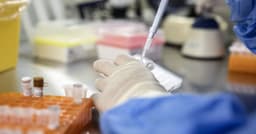 HIV CAR-T Study Shows Early Promise for Long-Term Virus Control