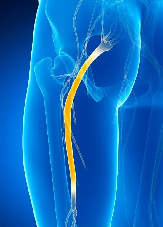 How Epidural Injections Help With Sciatica - Guide by PMCL
