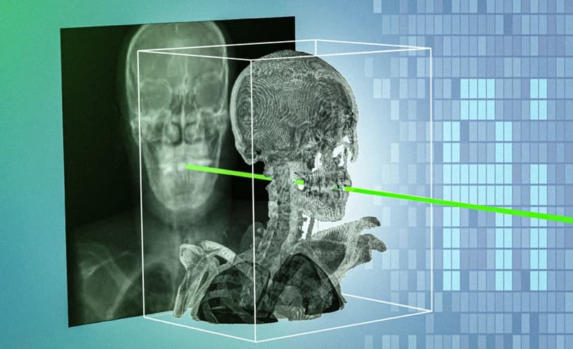Patient-Specific AI Tool Aligns X-Rays With 3D Scans For Surgical Navigation
