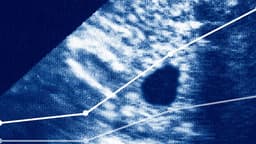 Maternal Health Tracking