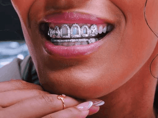 A'ja Wilson Grillz: Her Custom Gold & Diamond Set