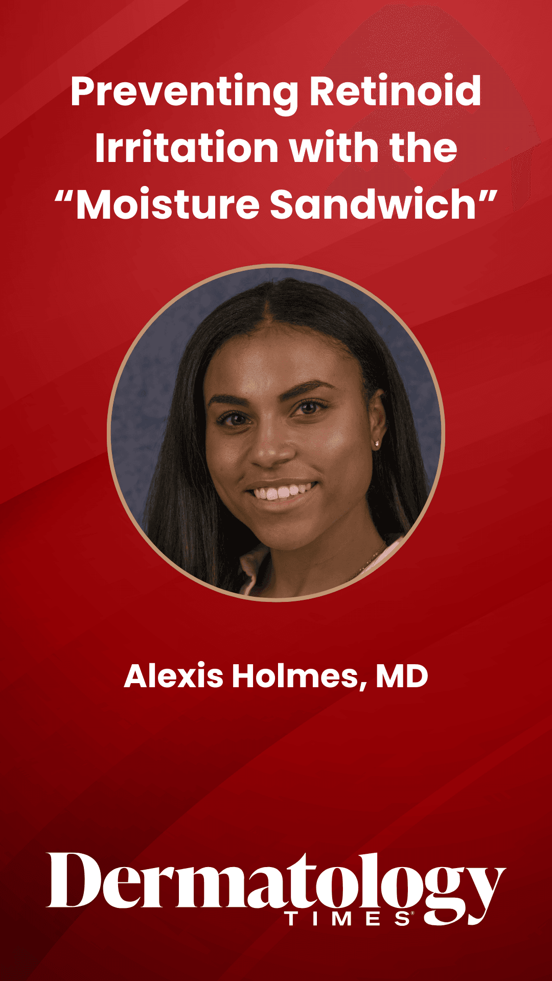 Preventing Retinoid Irritation with the “Moisture Sandwich” | Dermatology Times