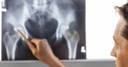 How to Prevent Hip Fractures: 7 Proven Steps for Seniors