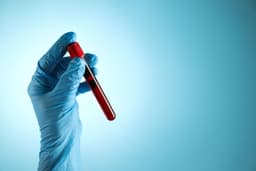 New Alzheimer's blood test could transform care for women ...