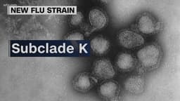 Flu and Norovirus Cases Surge