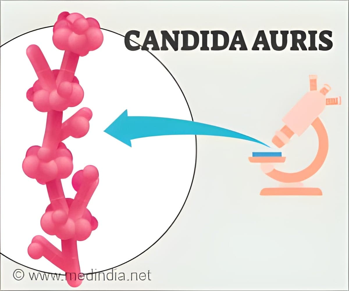 CDC Tracks 3437 Candida Auris Cases Across 27 US States