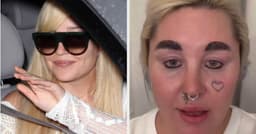 Amanda Bynes' Weight Loss Journey